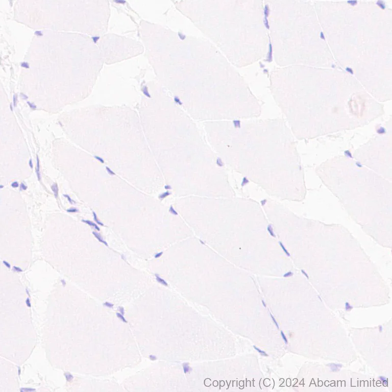 Immunohistochemistry (Formalin/PFA-fixed paraffin-embedded sections) - Anti-ME1 antibody [EPR28891-30] - BSA and Azide free (AB324831)