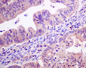 Immunohistochemistry (Formalin/PFA-fixed paraffin-embedded sections) - Anti-ME2 antibody [EP7217] (AB139686)