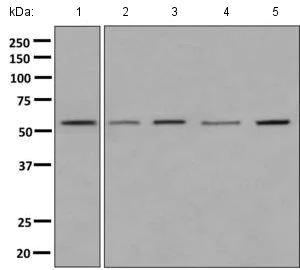 Western blot - Anti-ME2 antibody [EP7217] (AB139686)