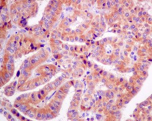 Immunohistochemistry (Formalin/PFA-fixed paraffin-embedded sections) - Anti-ME2 antibody [EP7217] - BSA and Azide free (AB240113)