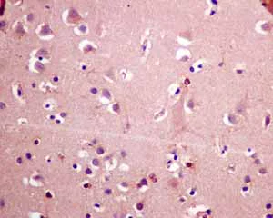 Immunohistochemistry (Formalin/PFA-fixed paraffin-embedded sections) - Anti-ME2 antibody [EP7217] - BSA and Azide free (AB240113)
