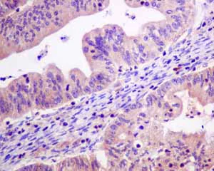Immunohistochemistry (Formalin/PFA-fixed paraffin-embedded sections) - Anti-ME2 antibody [EP7217] - BSA and Azide free (AB240113)
