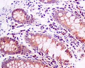 Immunohistochemistry (Formalin/PFA-fixed paraffin-embedded sections) - Anti-ME2 antibody [EP7217] - BSA and Azide free (AB240113)