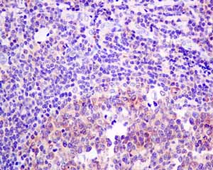 Immunohistochemistry (Formalin/PFA-fixed paraffin-embedded sections) - Anti-ME2 antibody [EP7217] - BSA and Azide free (AB240113)