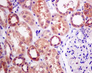 Immunohistochemistry (Formalin/PFA-fixed paraffin-embedded sections) - Anti-ME2 antibody [EP7217] - BSA and Azide free (AB240113)