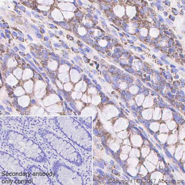 Immunohistochemistry (Formalin/PFA-fixed paraffin-embedded sections) - Anti-ME2 antibody [EPR7218] (AB126616)