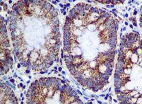 Immunohistochemistry (Formalin/PFA-fixed paraffin-embedded sections) - Anti-ME2 antibody [EPR7218] (AB126616)
