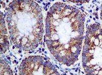 Immunohistochemistry (Formalin/PFA-fixed paraffin-embedded sections) - Anti-ME2 antibody [EPR7218] (AB126616)