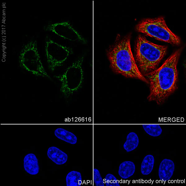 Immunocytochemistry/ Immunofluorescence - Anti-ME2 antibody [EPR7218] - BSA and Azide free (AB248127)