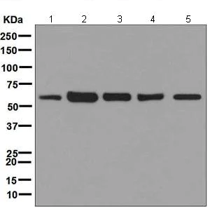 Western blot - Anti-ME2 antibody [EPR7218] - BSA and Azide free (AB248127)