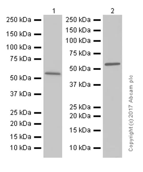 Western blot - Anti-ME2 antibody [EPR7218] - BSA and Azide free (AB248127)