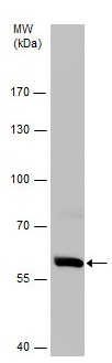 Western blot - Anti-ME3 antibody - C-terminal (AB229495)