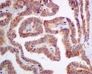 Immunohistochemistry (Formalin/PFA-fixed paraffin-embedded sections) - Anti-ME3 antibody [EPR10378] (AB172972)