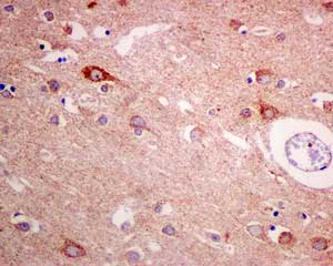Immunohistochemistry (Formalin/PFA-fixed paraffin-embedded sections) - Anti-ME3 antibody [EPR10378] (AB172972)
