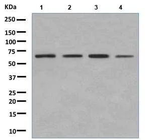 Western blot - Anti-ME3 antibody [EPR10378] (AB172972)