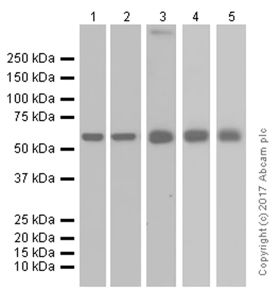 Western blot - Anti-ME3 antibody [EPR10378] (AB172972)