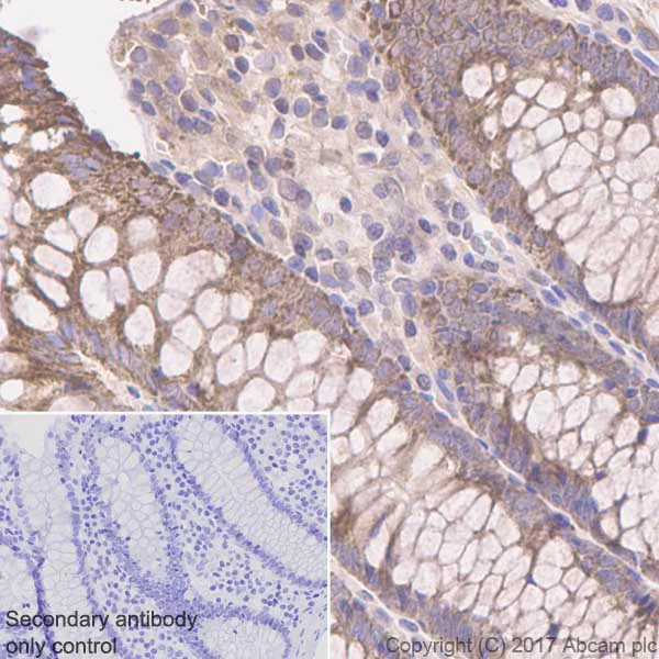 Immunohistochemistry (Formalin/PFA-fixed paraffin-embedded sections) - Anti-ME3 antibody [EPR10378] - BSA and Azide free (AB232459)