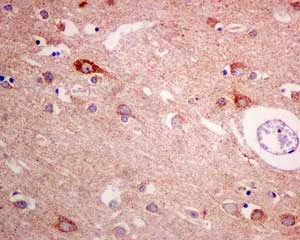 Immunohistochemistry (Formalin/PFA-fixed paraffin-embedded sections) - Anti-ME3 antibody [EPR10378] - BSA and Azide free (AB232459)