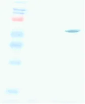 Western blot - Anti-Measles nucleoprotein antibody [2D7] (AB9882)