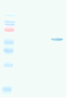 Western blot - Anti-Measles nucleoprotein antibody [3E1] (AB9397), expandable thumbnail
