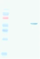 Western blot - Anti-Measles nucleoprotein antibody [3E1] (AB9397)