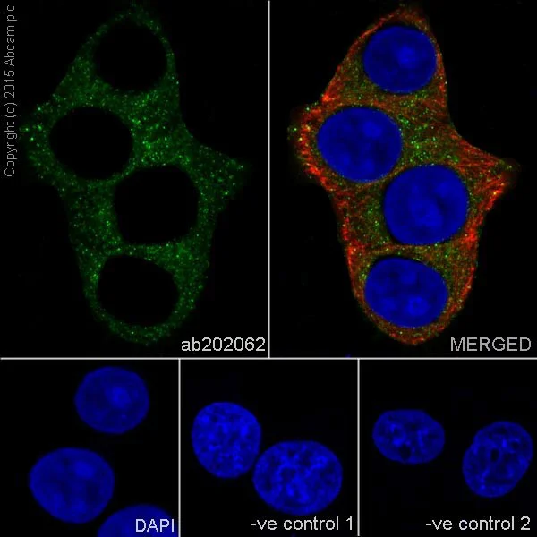 Immunocytochemistry/ Immunofluorescence - Anti-Meckelin antibody [EPR17187] (AB202062)