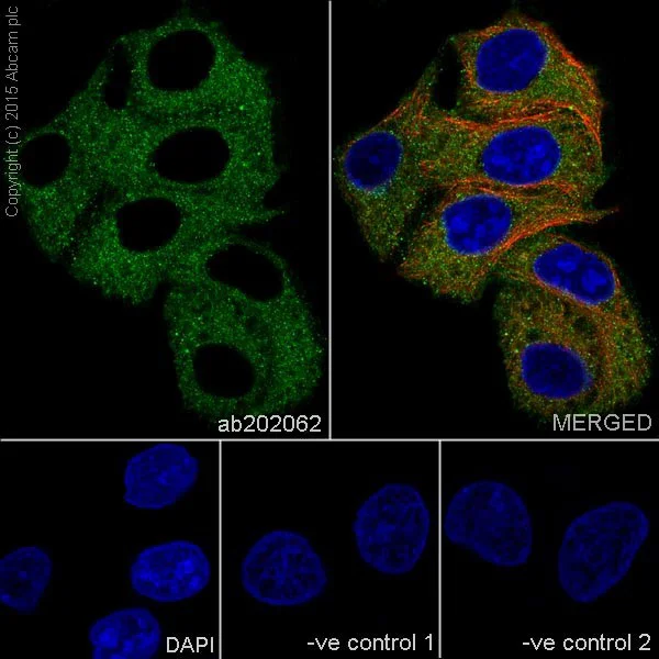 Immunocytochemistry/ Immunofluorescence - Anti-Meckelin antibody [EPR17187] (AB202062)