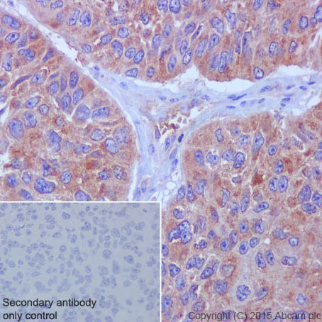 Immunohistochemistry (Formalin/PFA-fixed paraffin-embedded sections) - Anti-Meckelin antibody [EPR17187] (AB202062)