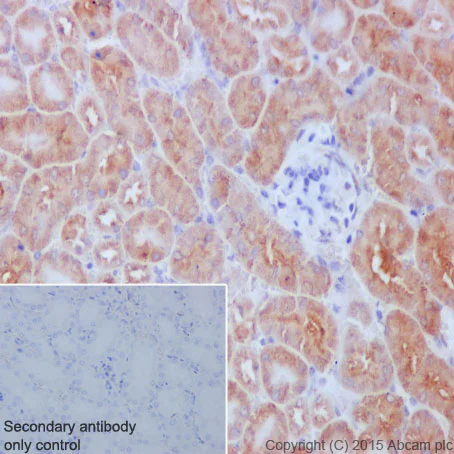 Immunohistochemistry (Formalin/PFA-fixed paraffin-embedded sections) - Anti-Meckelin antibody [EPR17187] (AB202062)