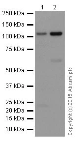 Western blot - Anti-Meckelin antibody [EPR17187] (AB202062)