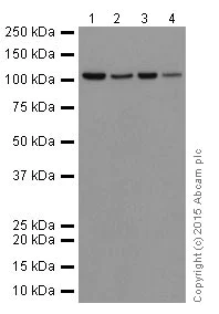 Western blot - Anti-Meckelin antibody [EPR17187] (AB202062)