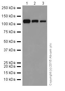 Western blot - Anti-Meckelin antibody [EPR17187] (AB202062)