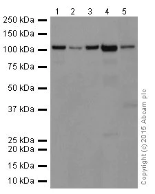 Western blot - Anti-Meckelin antibody [EPR17187] (AB202062)