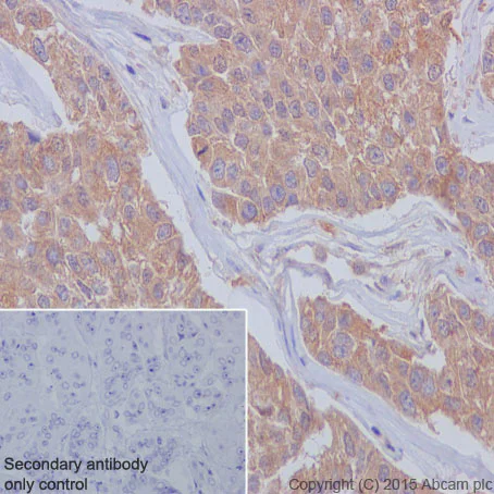 Immunohistochemistry (Formalin/PFA-fixed paraffin-embedded sections) - Anti-Meckelin antibody [EPR17187] - BSA and Azide free (AB242412)