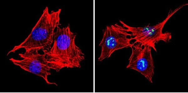 Immunocytochemistry/ Immunofluorescence - Anti-MeCP2 antibody (AB2828)