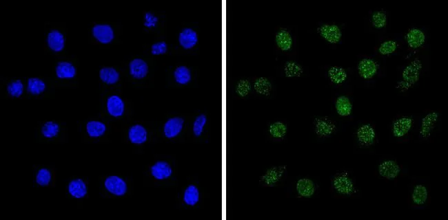 Immunocytochemistry/ Immunofluorescence - Anti-MeCP2 antibody (AB2828)