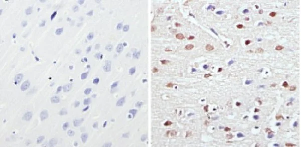 Immunohistochemistry (Formalin/PFA-fixed paraffin-embedded sections) - Anti-MeCP2 antibody (AB2828)