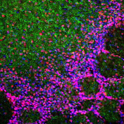 Immunohistochemistry - Anti-MeCP2 Antibody (AB327074)
