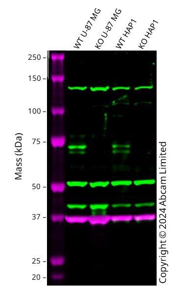 Western blot - Anti-MeCP2 antibody - ChIP Grade (AB195393), expandable thumbnail