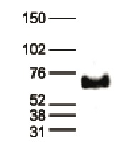 Western blot - Anti-MeCP2 antibody - ChIP Grade (AB195393), expandable thumbnail