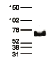 Western blot - Anti-MeCP2 antibody - ChIP Grade (AB195393)