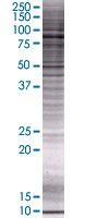 MeCP2 overexpression 293T lysate (whole cell)