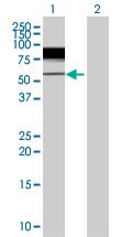 Western blot - MeCP2 overexpression 293T lysate (whole cell) (AB94140)