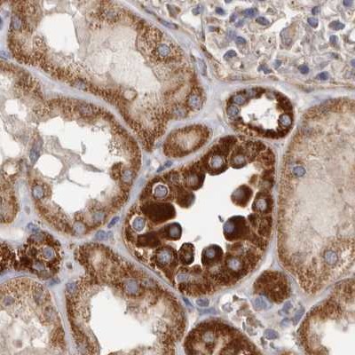 Immunohistochemistry (Formalin/PFA-fixed paraffin-embedded sections) - Anti-MECR antibody (AB254707), expandable thumbnail