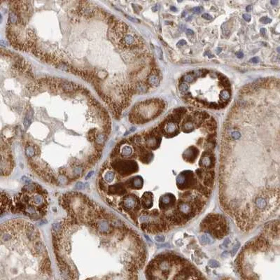 Immunohistochemistry (Formalin/PFA-fixed paraffin-embedded sections) - Anti-MECR antibody (AB254707)