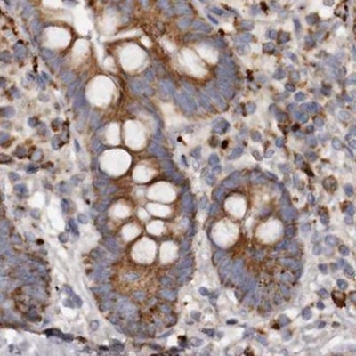 Immunohistochemistry (Formalin/PFA-fixed paraffin-embedded sections) - Anti-MECR antibody (AB254707), expandable thumbnail