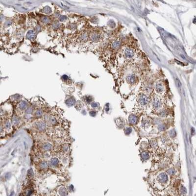 Immunohistochemistry (Formalin/PFA-fixed paraffin-embedded sections) - Anti-MECR antibody (AB254707), expandable thumbnail