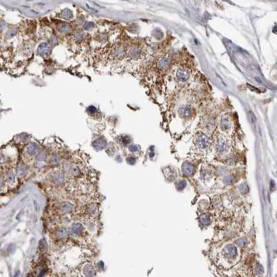 Immunohistochemistry (Formalin/PFA-fixed paraffin-embedded sections) - Anti-MECR antibody (AB254707)