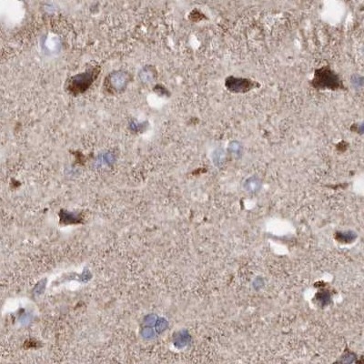 Immunohistochemistry (Formalin/PFA-fixed paraffin-embedded sections) - Anti-MECR antibody (ab254707), expandable thumbnail