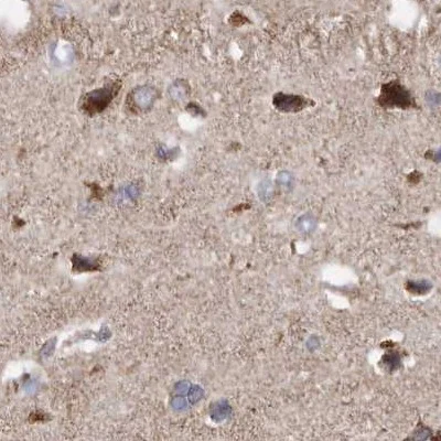 Immunohistochemistry (Formalin/PFA-fixed paraffin-embedded sections) - Anti-MECR antibody (AB254707)